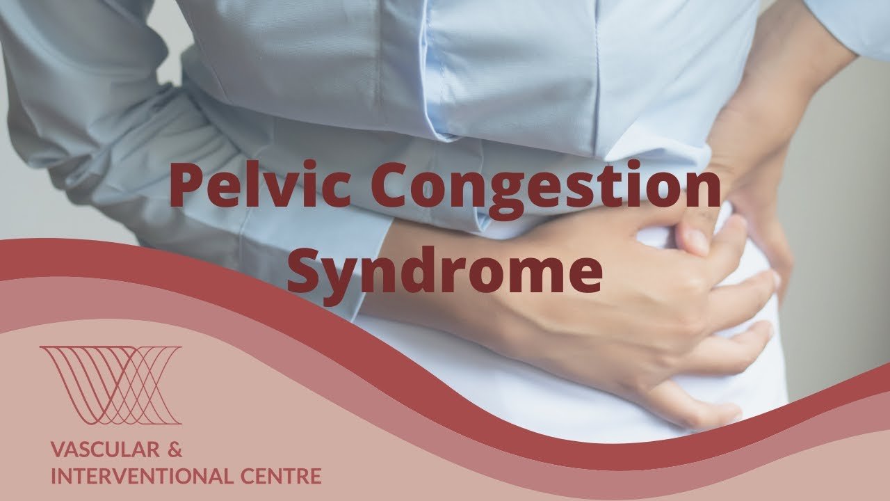 Why Awareness of Pelvic Congestion Syndrome Is Growing in Albuquerque